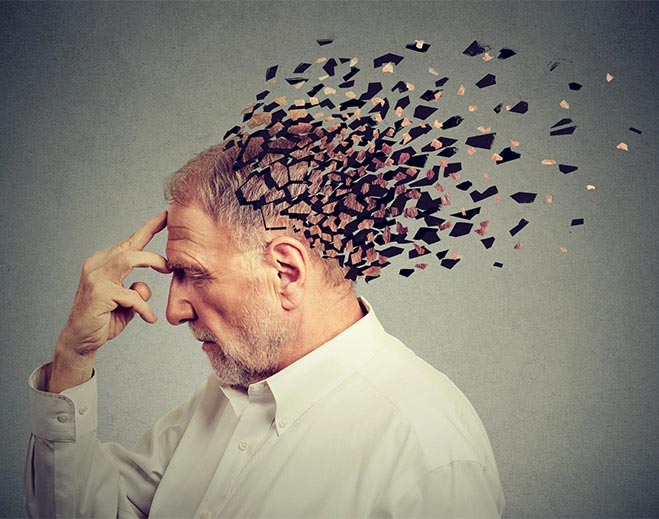Ilustración de pérdida de memoria cognitiva