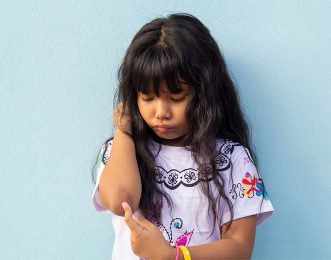 Niña observando irritación en el brazo