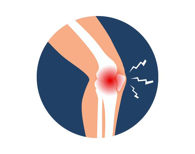 Ilustración de dolor en la articulación de la rodilla
